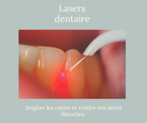 utilisation d’un laser dentaire