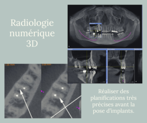 radiologie dentaire et numérique 3D